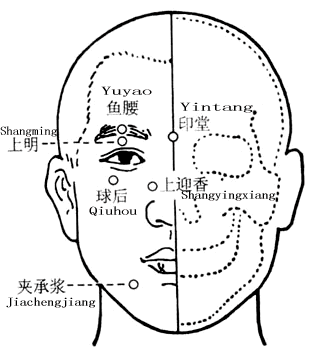 印堂穴